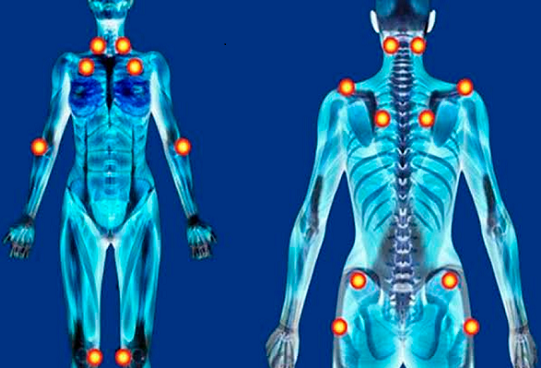 Os direitos da pessoa com fibromialgia