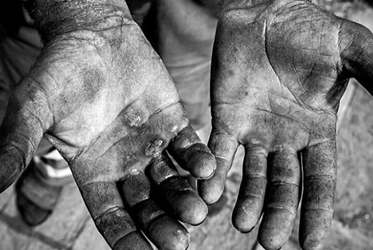 Uma história baseada em outra história