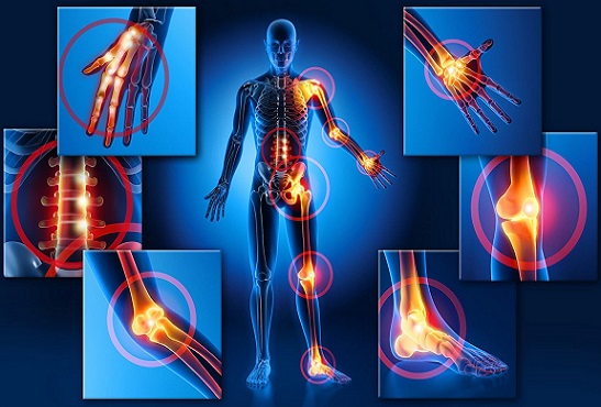 Fevereiro roxo: fibromialgia, dor invisível e direitos reais